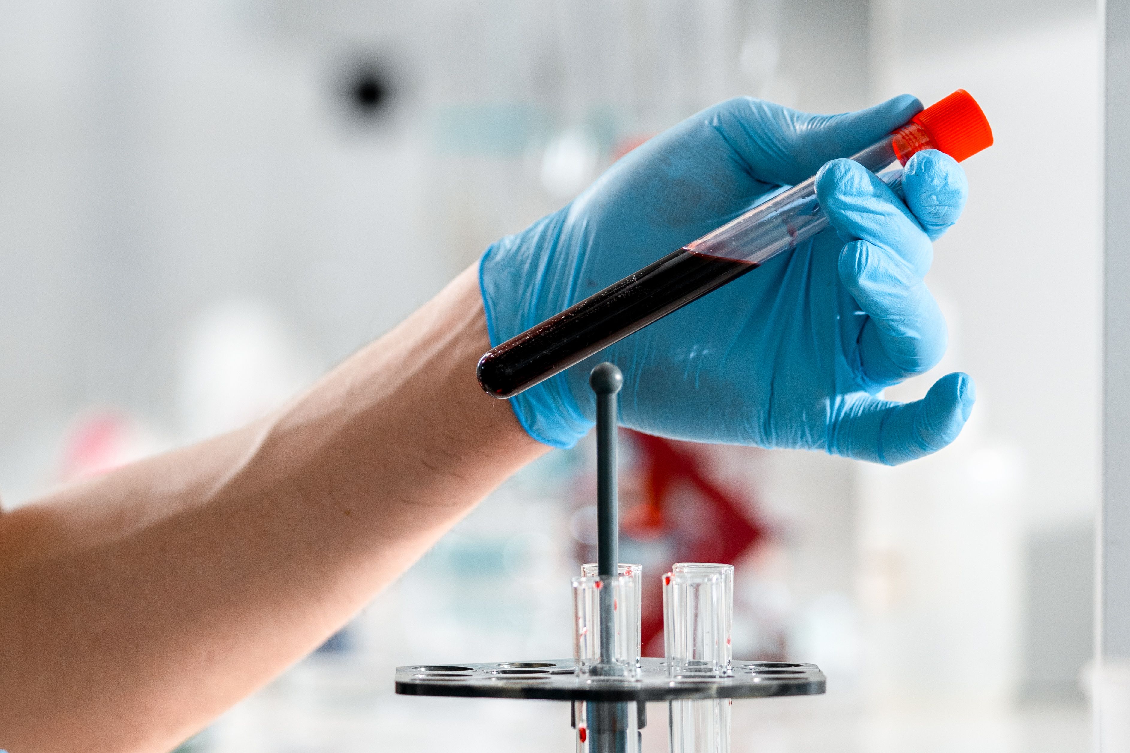 holding vial of blood for testing.